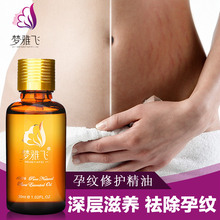 “闪电”跑赢博尔特，你怎么看